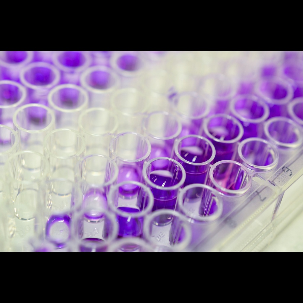 Human	Human NEFL Neurofilament, Light Polypeptide  ELISA Kit size: 96 Tests